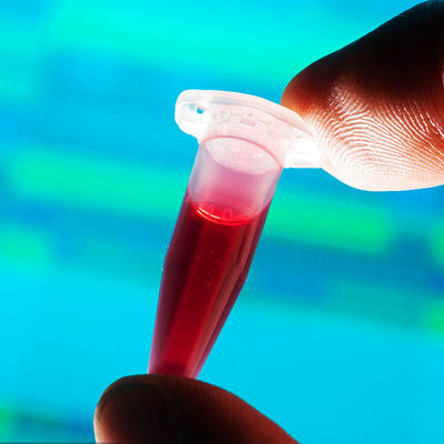 Fda Erkende van de het Contact met levensmiddelenzuigfles van de Testlaboratoria Snelle Opsporing de Derdeverificatieservice